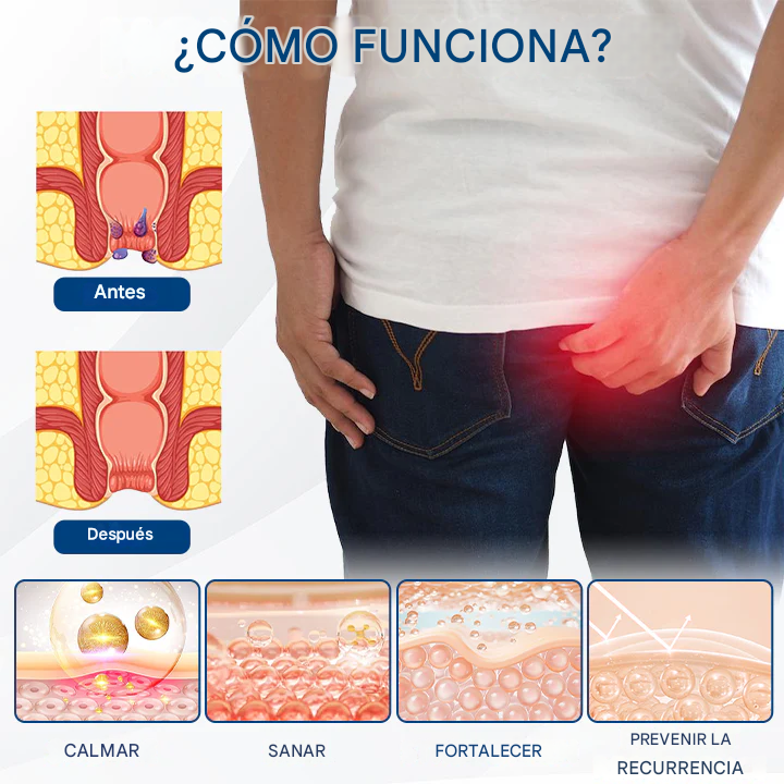 Spray Herbal Para Las Hemorroides