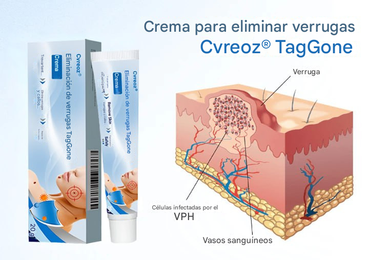 Crema para eliminar verrugas Cvreoz® TagGone