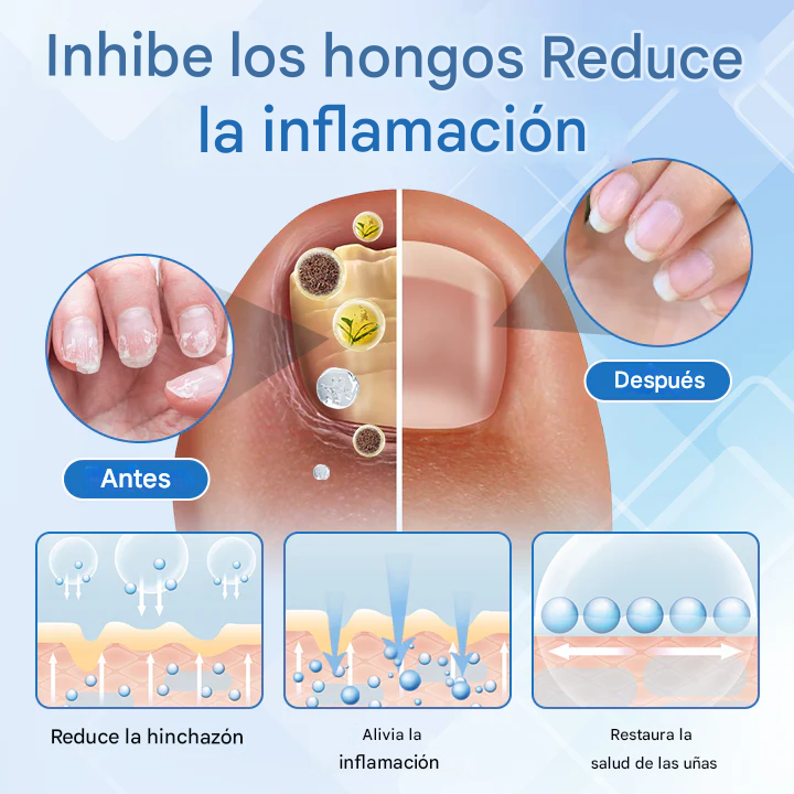 Spray Para El Tratamiento De La Dermatitis