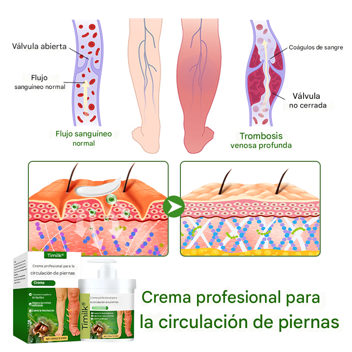 Crema para pies antiedema "FluidEase" de Timilk® — ✅ ¡Clínicamente probada para eliminar las venas varicosas en solo 7 días!