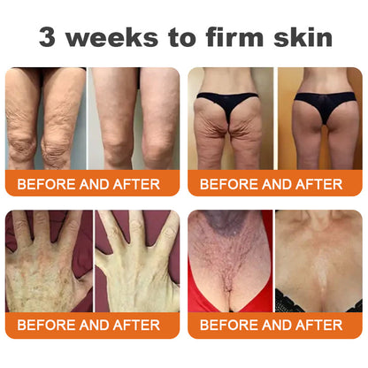 🔥🐝(PROMO 2x1 ) Flysmus™ Suero reafirmante con veneno de abeja y botox🐝🔥
