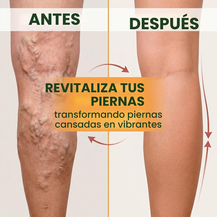 Paga 1 Lleva 3 (36unds) Parches Naturales Para Varices Y Para Las Piernas Cansadas - VeinPatch™