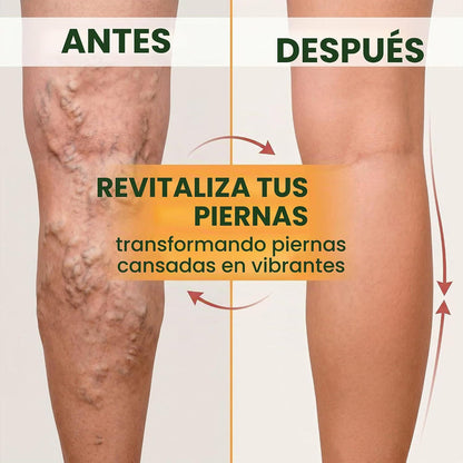 Paga 1 Lleva 3 (36unds) Parches Naturales Para Varices Y Para Las Piernas Cansadas - VeinPatch™