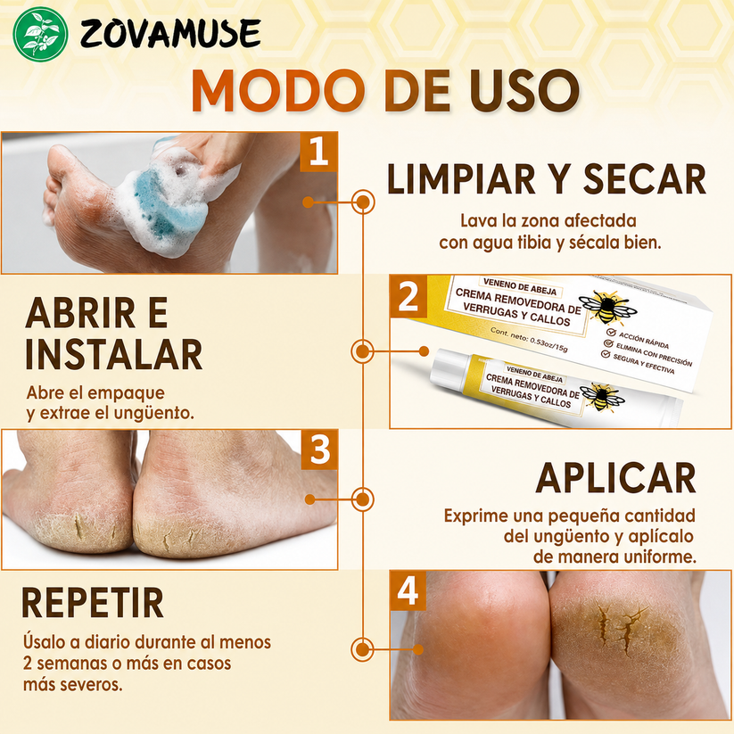 Crema Removedora De Callos Y Durezas Con Veneno De Abeja