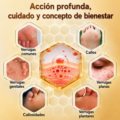 Crema Removedora De Callos Y Durezas Con Veneno De Abeja