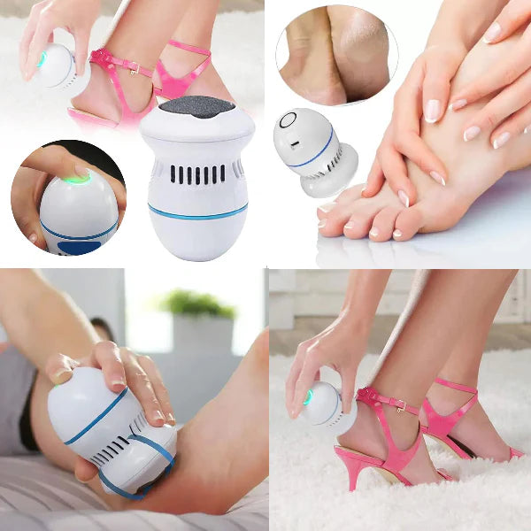 SuaviFeet® Quita Callos Electrico