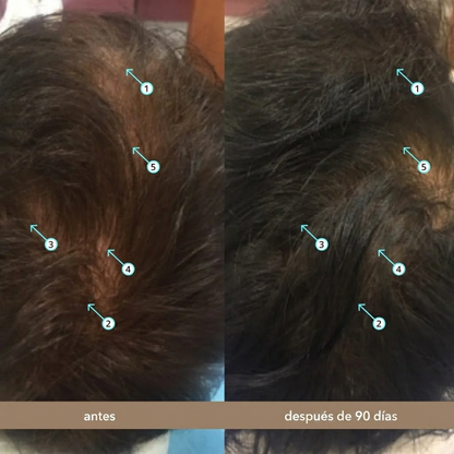 Sérum Avanzado De Densidad Capilar Con Nanoxidil 5%