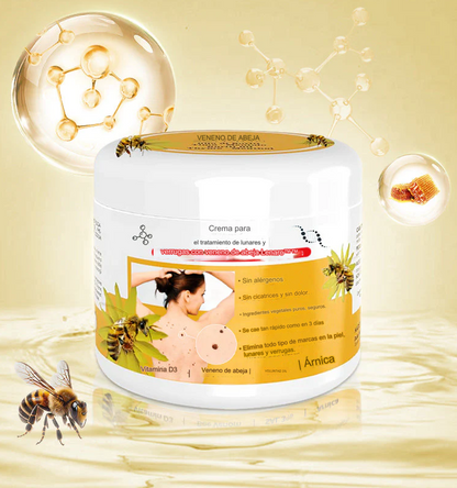 PROMO 2X1 🔥🐝 Crema para el tratamiento de lunares y verrugas con veneno de abeja Lenaro
