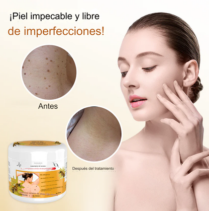 PROMO 2X1 🔥🐝 Crema para el tratamiento de lunares y verrugas con veneno de abeja Lenaro