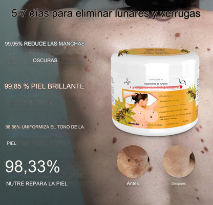 PROMO 2X1 🔥🐝 Crema para el tratamiento de lunares y verrugas con veneno de abeja Lenaro