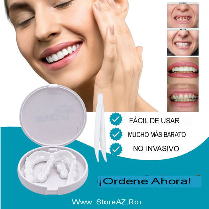 🦷Carillas Dentales🦷
