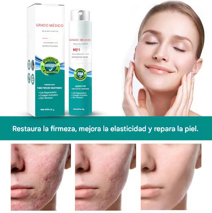 DermaRenew™ – Spray Avanzado para la Eliminación de Cicatrices