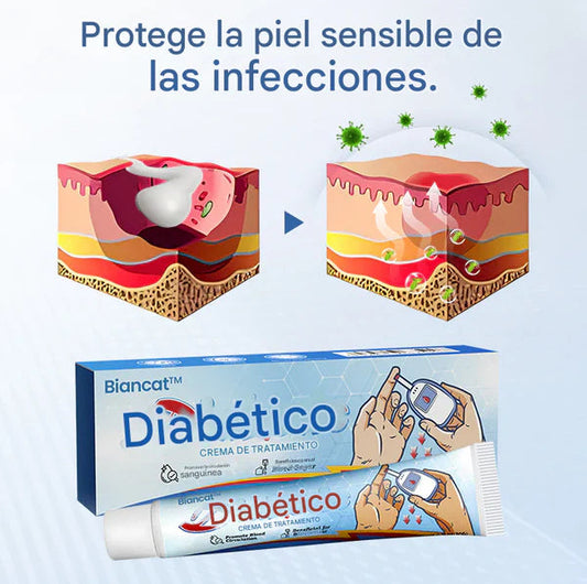 PROMO 2X1 Biancat™ - Crema para el tratamiento de la diabetes