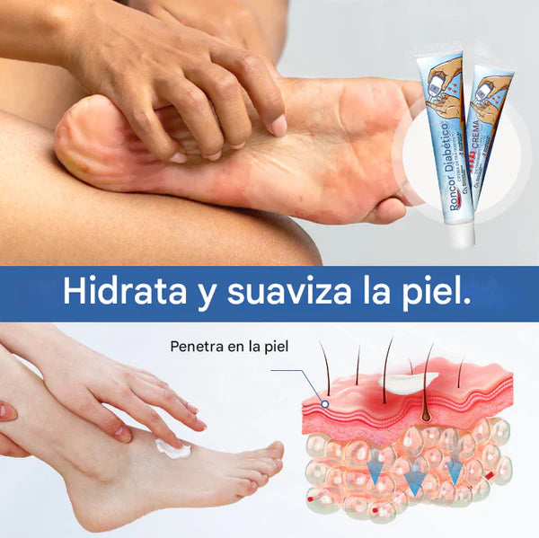 PROMO 2X1 Biancat™ - Crema para el tratamiento de la diabetes