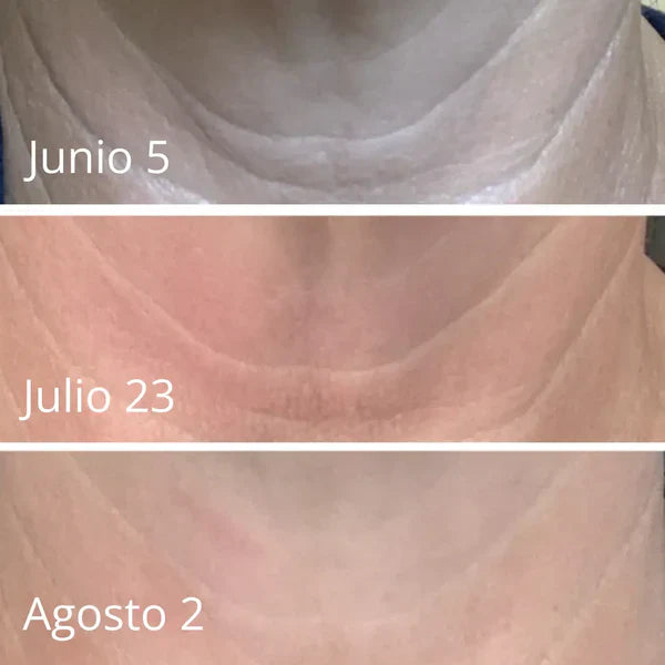 LuxeLift - Crema Reafirmante Y Rejuvenecedora De Piel
