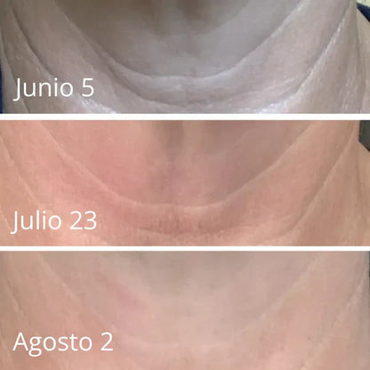 LuxeLift - Crema Reafirmante Y Rejuvenecedora De Piel