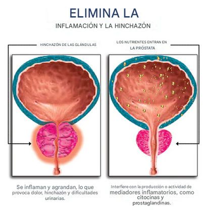 Oveallgo™ ProstaFlow - Alivio rápido de la Prostata