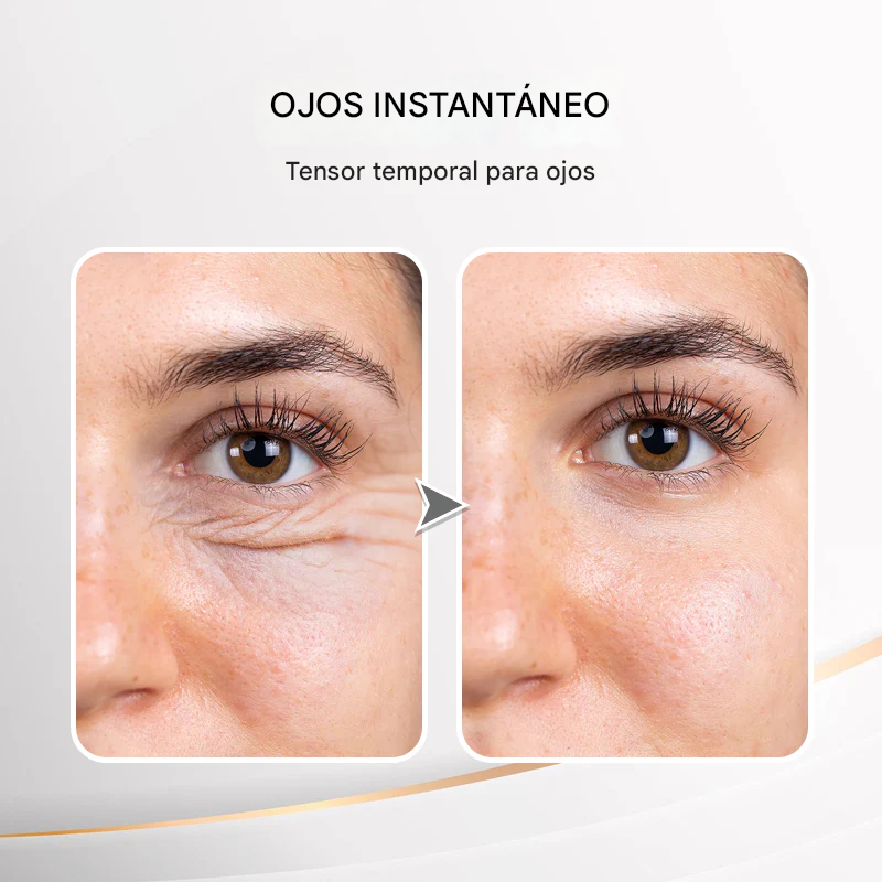 LOVILDS™  - Crema Reafirmante para Ojos