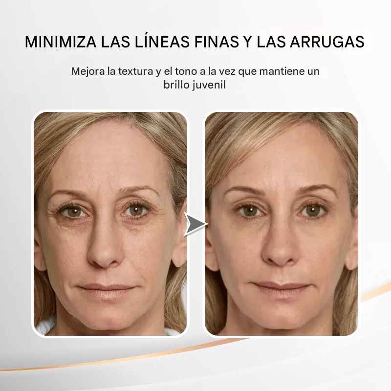 LOVILDS™  - Crema Reafirmante para Ojos