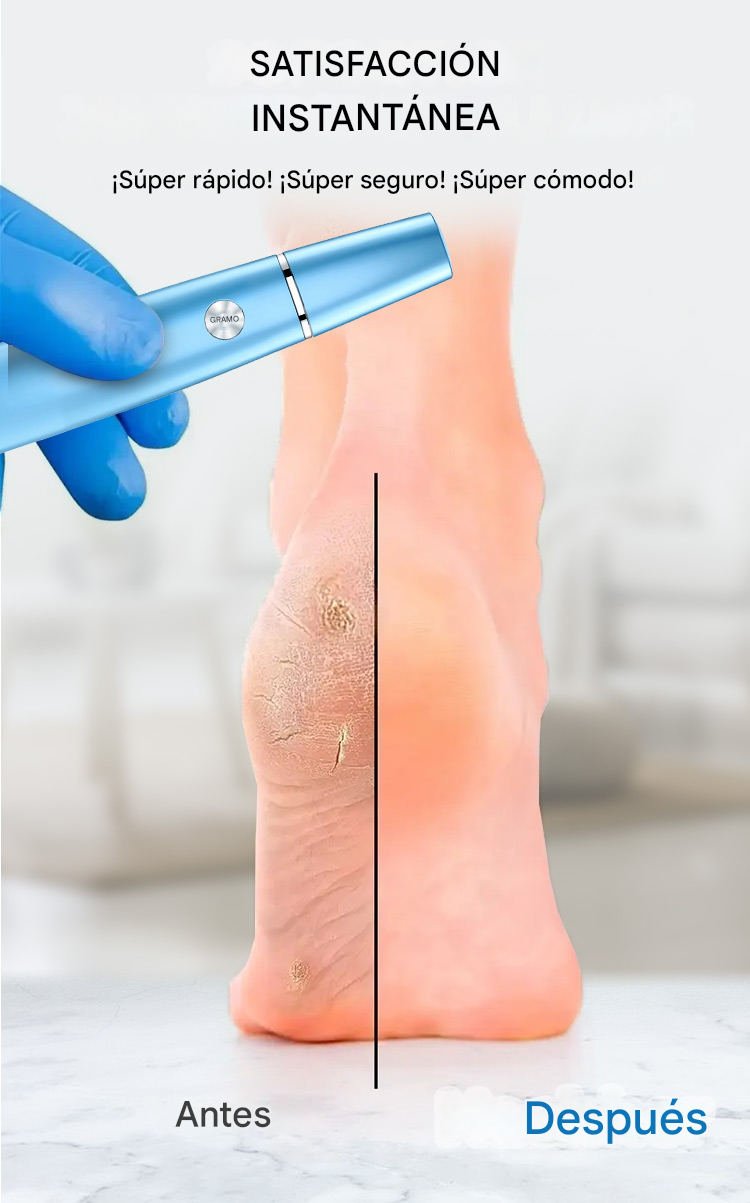 SilkyStep™ – Removedor Eléctrico de Callos Profesional