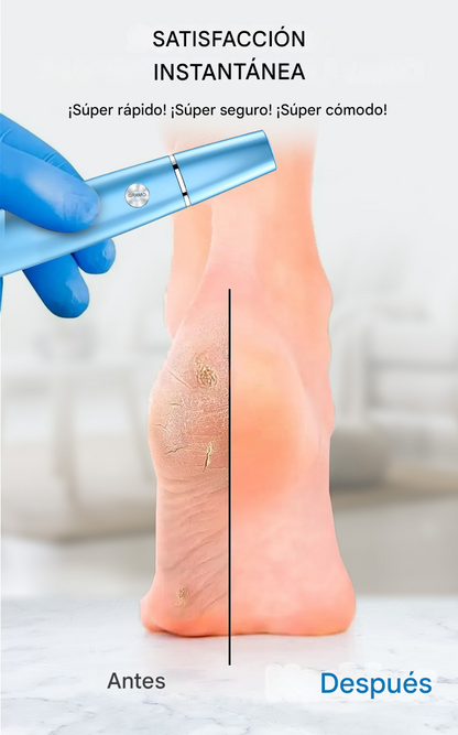 SilkyStep™ – Removedor Eléctrico de Callos Profesional