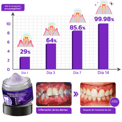 BBOJI™ Polvo mineral para la restauración dental