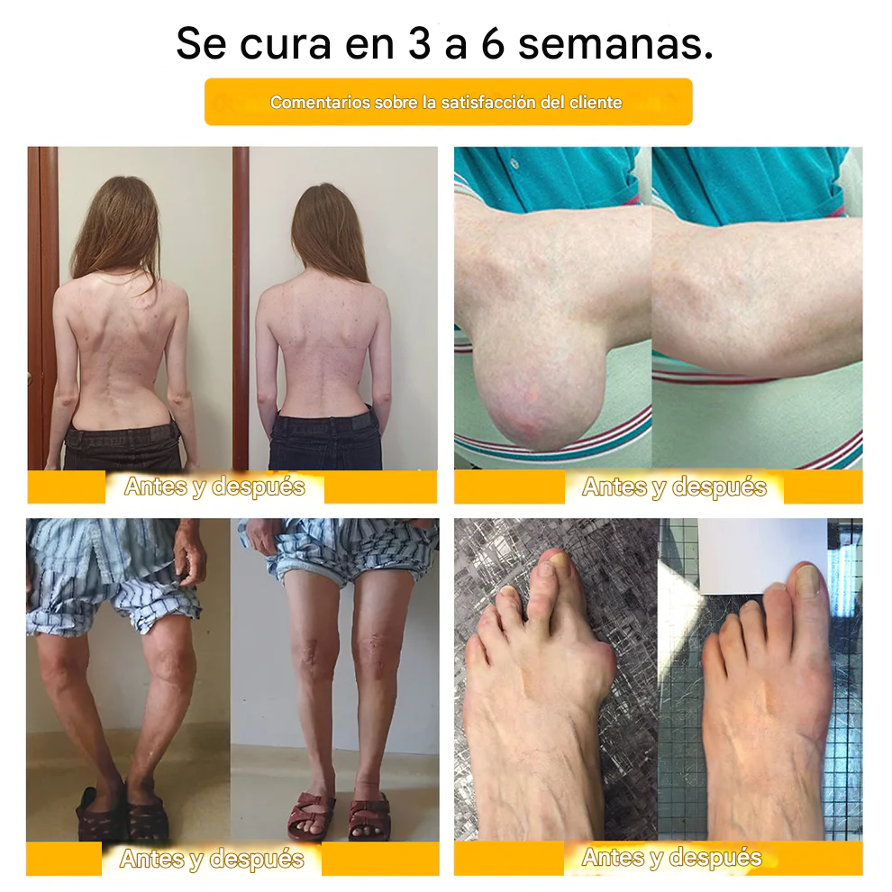 PROMO 2x1 - Crema Para La Curación De Huesos Y El Alivio Del Dolor Con Bótox