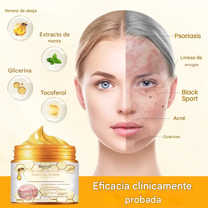 Crema para el cuidado intensivo de la piel Biancat™