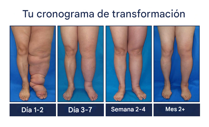 Promo 2X1 Crema para la circulación  SwellRelief