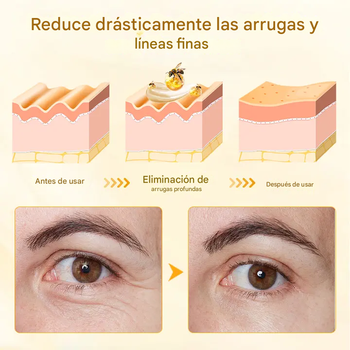 Crema para el cuidado intensivo de la piel Biancat™