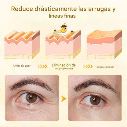 Crema para el cuidado intensivo de la piel Biancat™