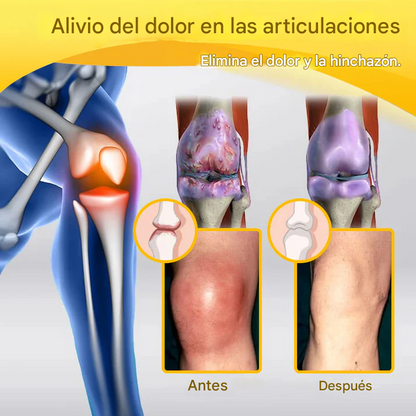 PROMO 2x1 - Crema Para La Curación De Huesos Y El Alivio Del Dolor Con Bótox