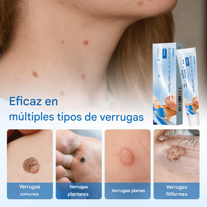Crema para eliminar verrugas Cvreoz® TagGone