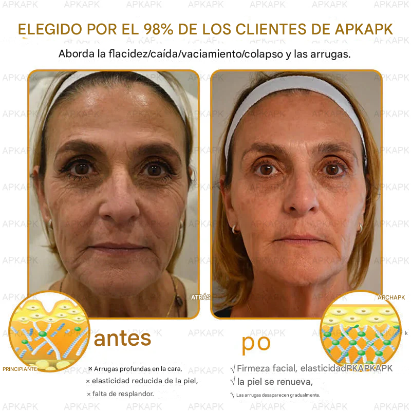 Crema Regeneradora De Piel Con Veneno De Abeja APPAPK®