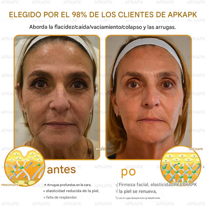 Crema Regeneradora De Piel Con Veneno De Abeja APPAPK®