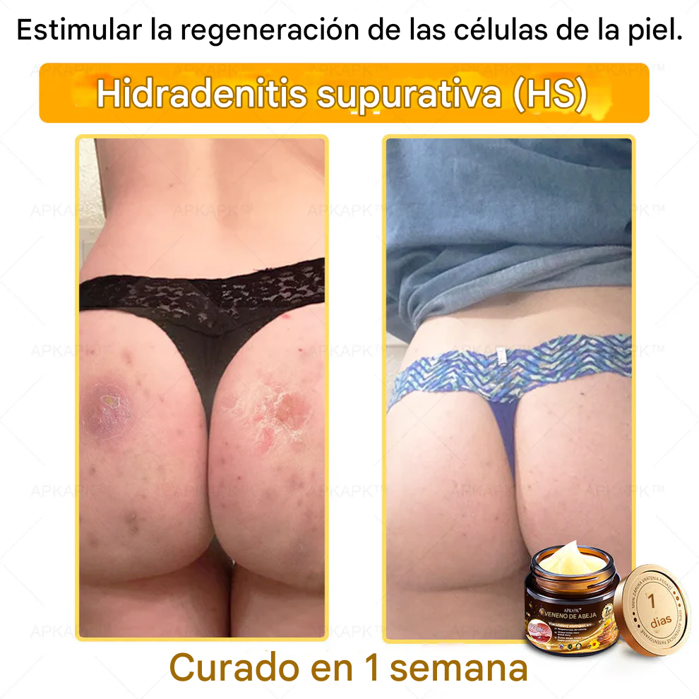 Crema Regeneradora De Piel Con Veneno De Abeja APPAPK®