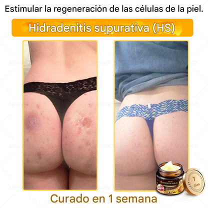 Crema Regeneradora De Piel Con Veneno De Abeja APPAPK®