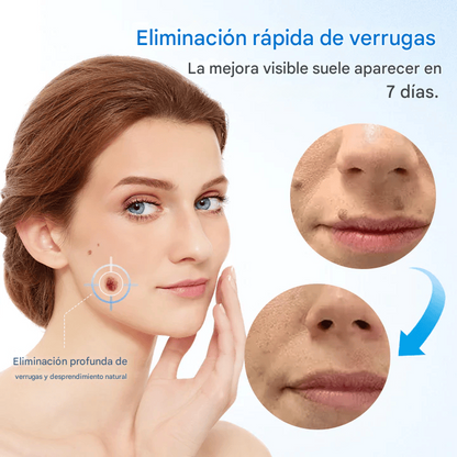 Crema para eliminar verrugas Cvreoz® TagGone