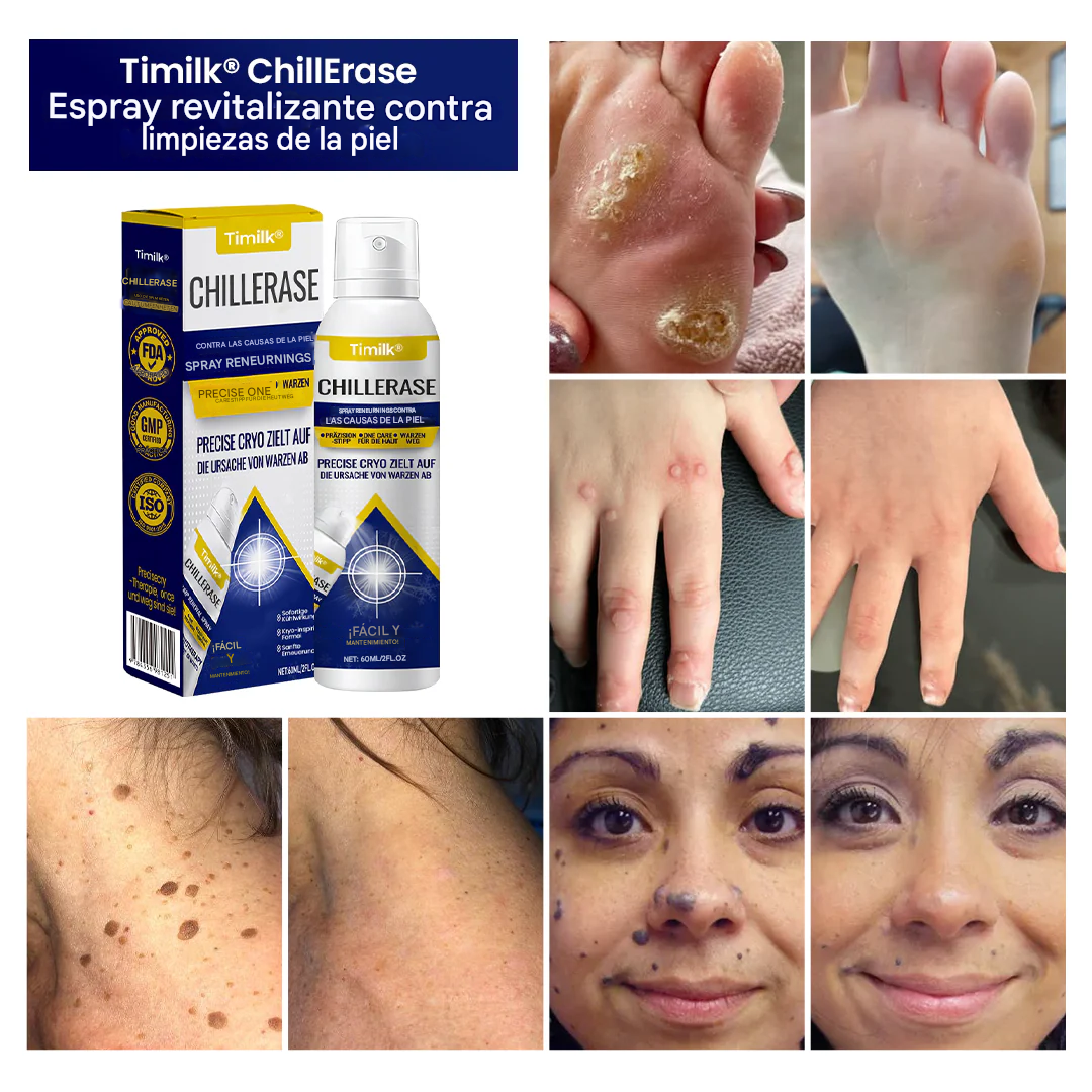 Spray renovador Timilk® ChillErase para imperfecciones