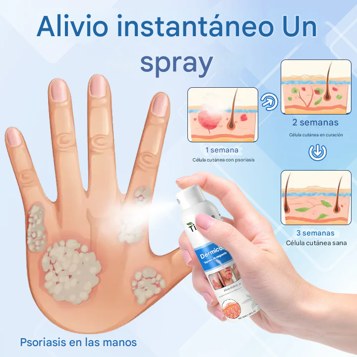 Spray Para El Tratamiento De La Dermatitis