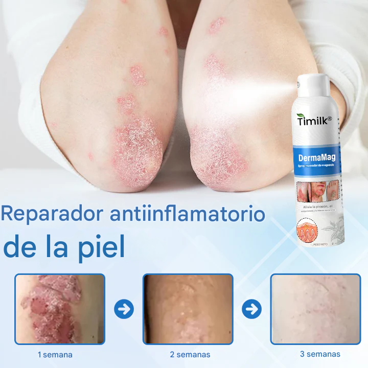 Spray Para El Tratamiento De La Dermatitis