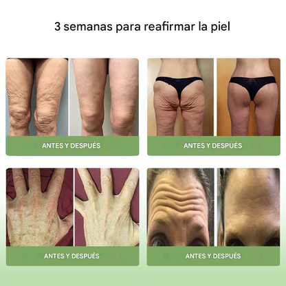 LOVILDS™𝐋𝐮𝐱𝐮𝐫𝐢𝐨𝐮𝐬 - Crema Reafirmante de Colágeno