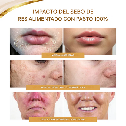 Dermserene - Bálsamo de miel y sebo de res