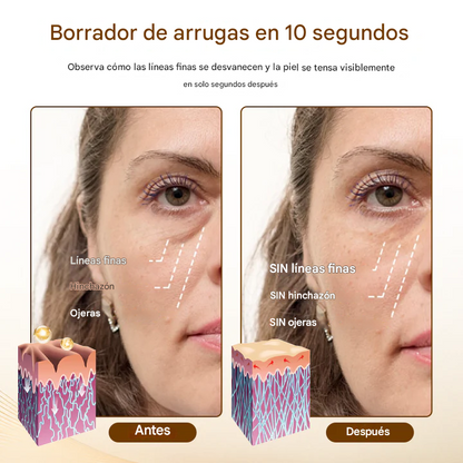 Biancat® Liftora 10s Suero antiarrugas