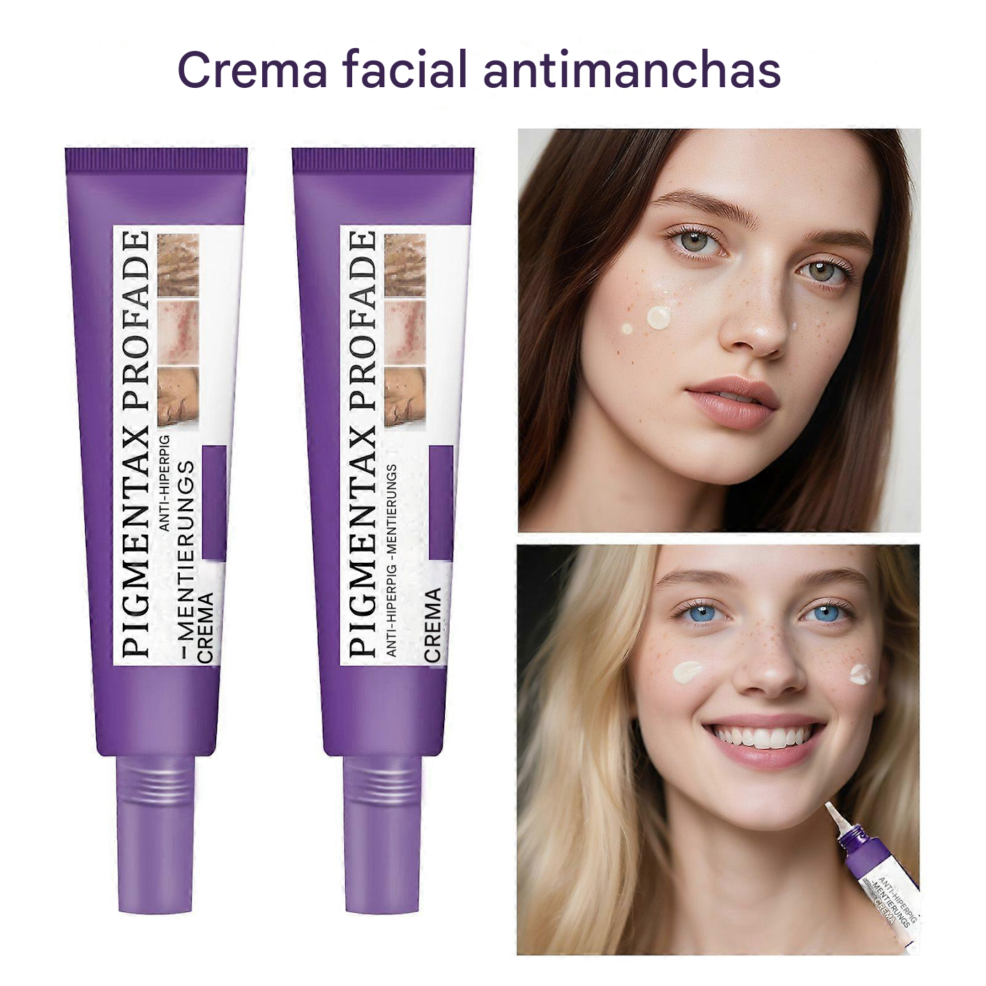 Crema Epiglow Melanex Advanced Anti-hiperpigmentación