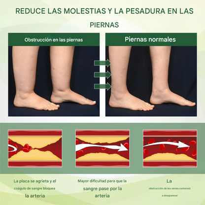 Promo 2x1 Crema de masaje para la terapia de edemas