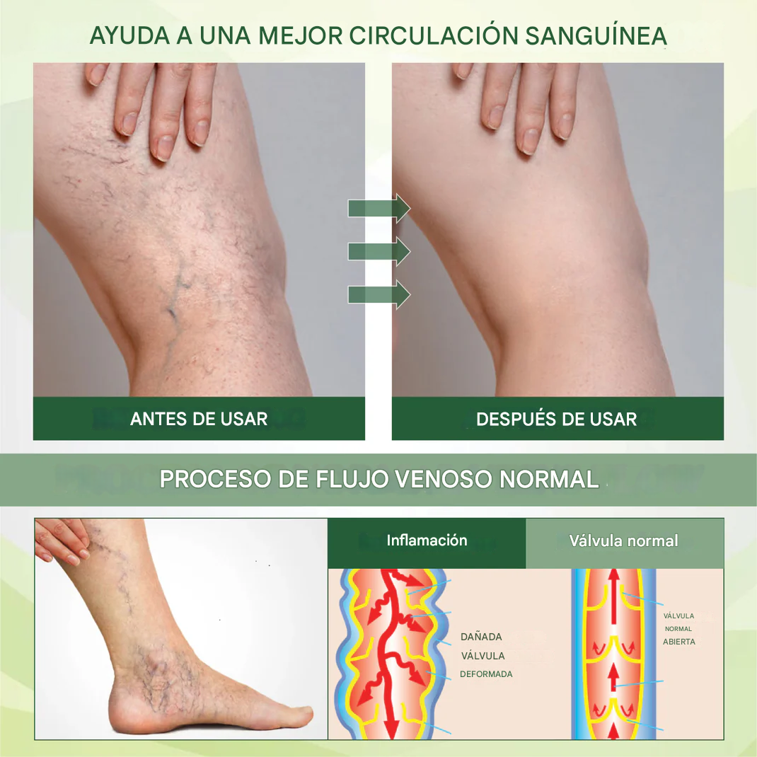 Promo 2x1 Crema de masaje para la terapia de edemas