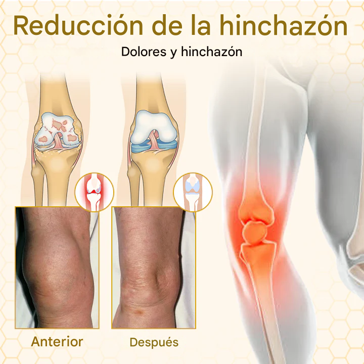 🔥PROMO 2x1🔥 Crema Terapéutica Con Veneno De Abejas VenomFlex