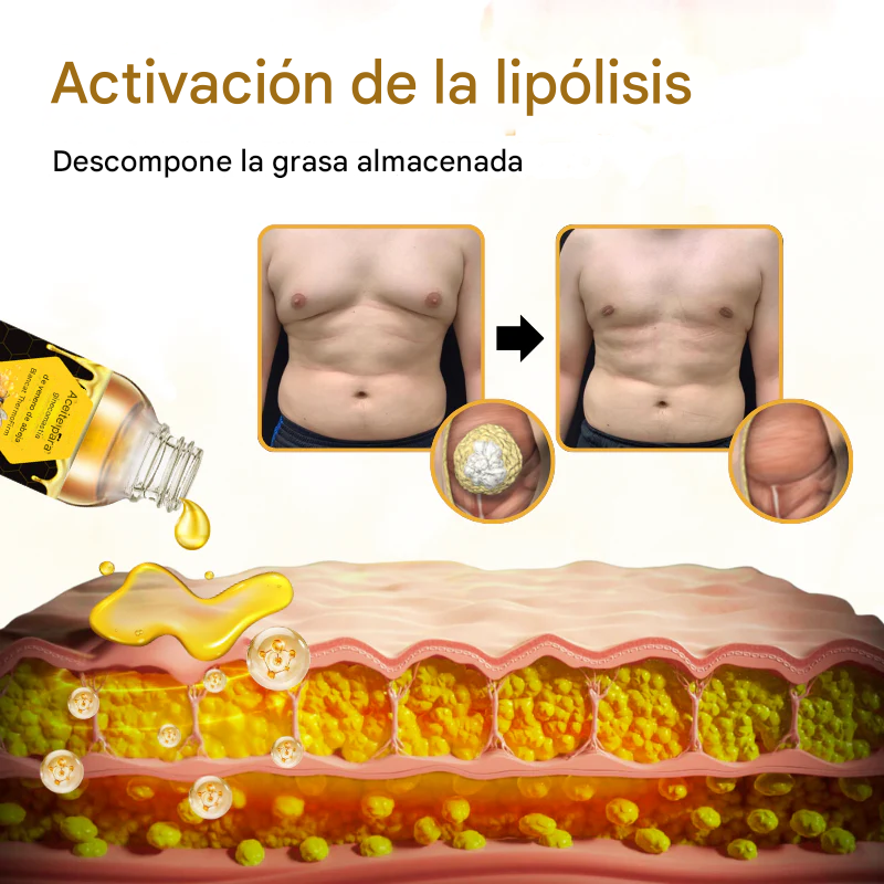 🔥PROMO 2X1 🔥Aceite Para Ginecomastia Con Veneno De Abeja Biancat® ThermoFirm