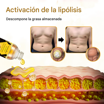 🔥PROMO 2X1 🔥Aceite Para Ginecomastia Con Veneno De Abeja Biancat® ThermoFirm